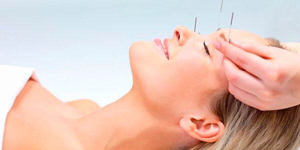 tipos de acupuntura