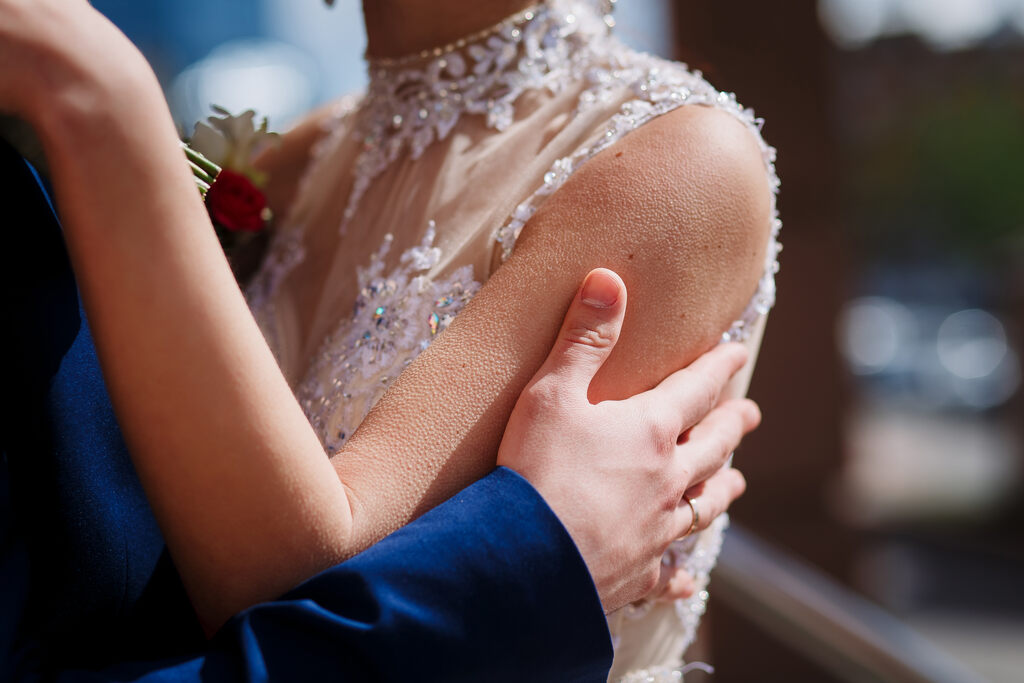Noiva e noivo dançando, ela está com o braço arrepiado, representando o significado de arrepios no relacionamento amoroso